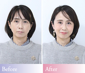 上品美人メイクビフォーアフター,くぼみ目が原因の疲れ見えから魅力を活かした華やかな美人印象へ
